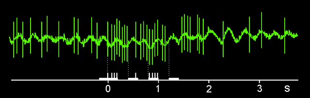 delay1.gif (12478 bytes)