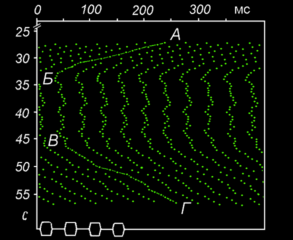 rhythm2.gif (15758 bytes)