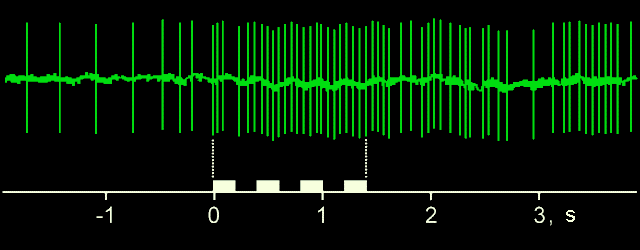 tuning2.gif (16477 bytes)