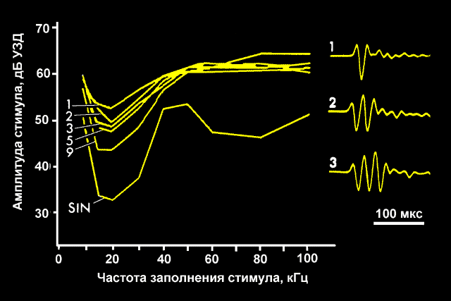 audiog3.gif (13442 bytes)