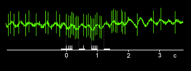 delay1.gif (12635 bytes)