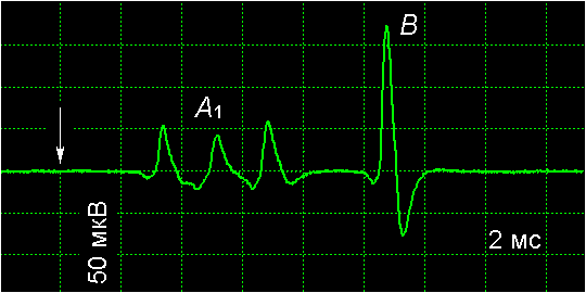 ef1.gif (5338 bytes)